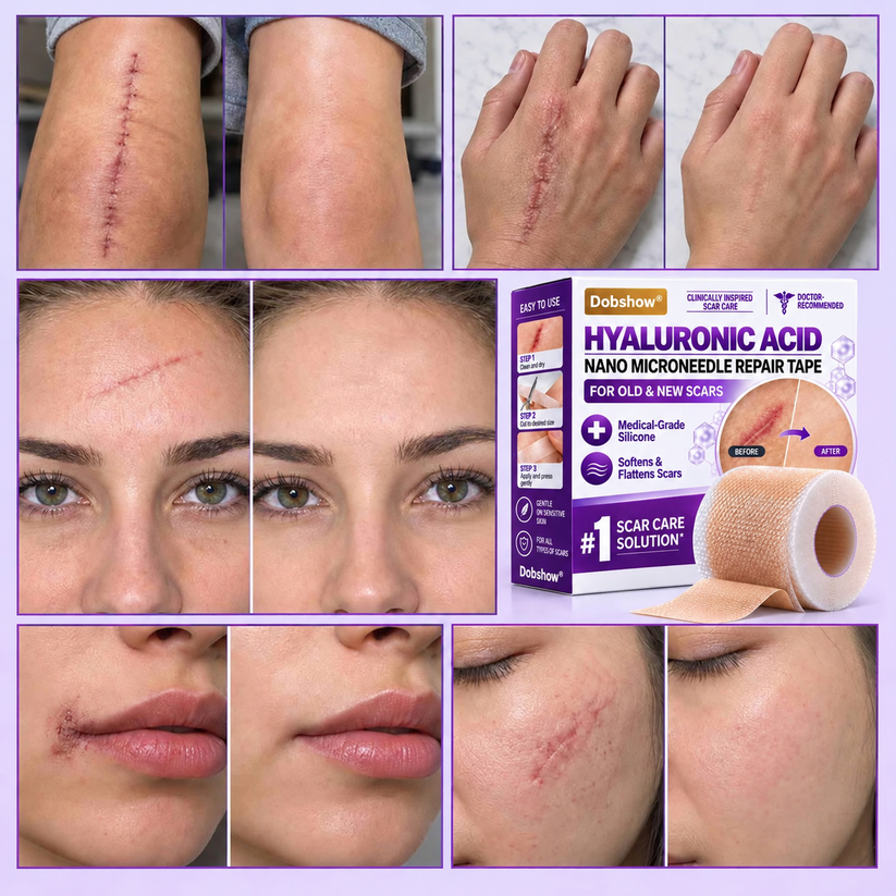 Medical-Grade Nano Microneedle Scar Repair Tape: Targeted Scar Care For Surgical, C-Section, Raised & Stubborn Scars