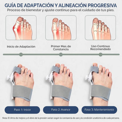 Adjustable Bunion Corrector (Hallux Valgus)